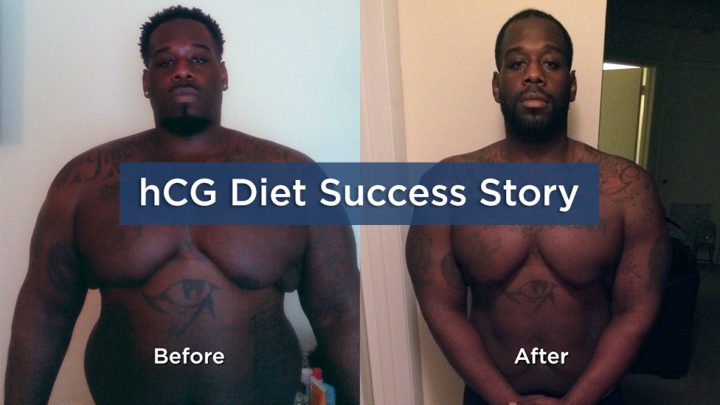 hCG Diet Success Story
