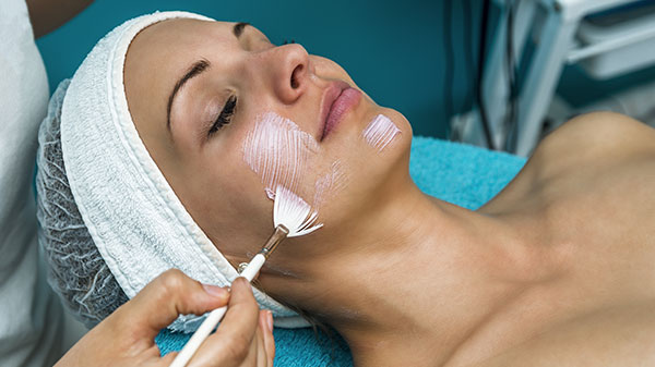 chemical-peel