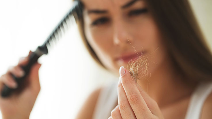 Hair-Loss