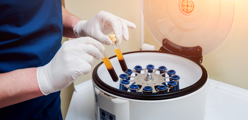 PRP therapy Silver Spring