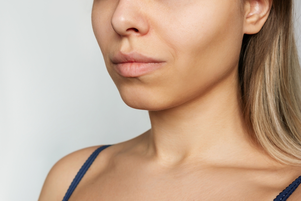 woman showing the aesthetic side of rapid weight loss in her face