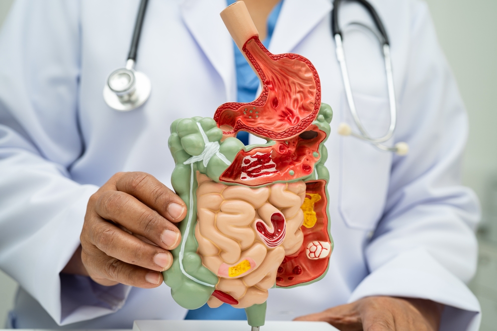 doctor holding model for digestive health in Silver Spring